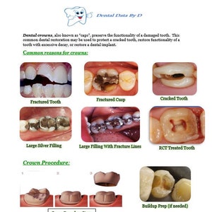 Folleto de educación para el paciente dental: procedimiento de coronas
