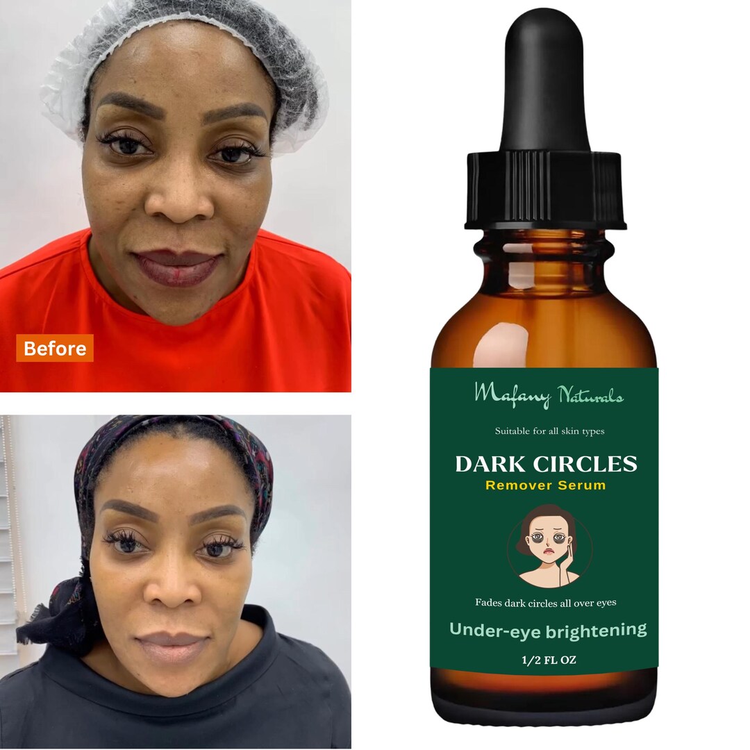 The Top 5 Eye Serums Of 2025 | Consumers Survey The Top 5 Eye Serums Of 2025 | Consumers Survey