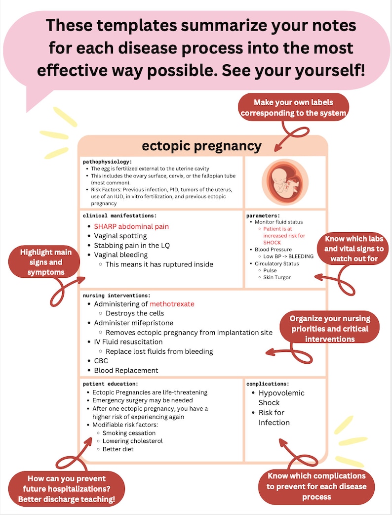 May include: A pink and white infographic with the title "ectopic pregnancy" and a cartoon illustration of a fetus. The infographic includes information about the condition, symptoms, nursing interventions, complications, and patient education.