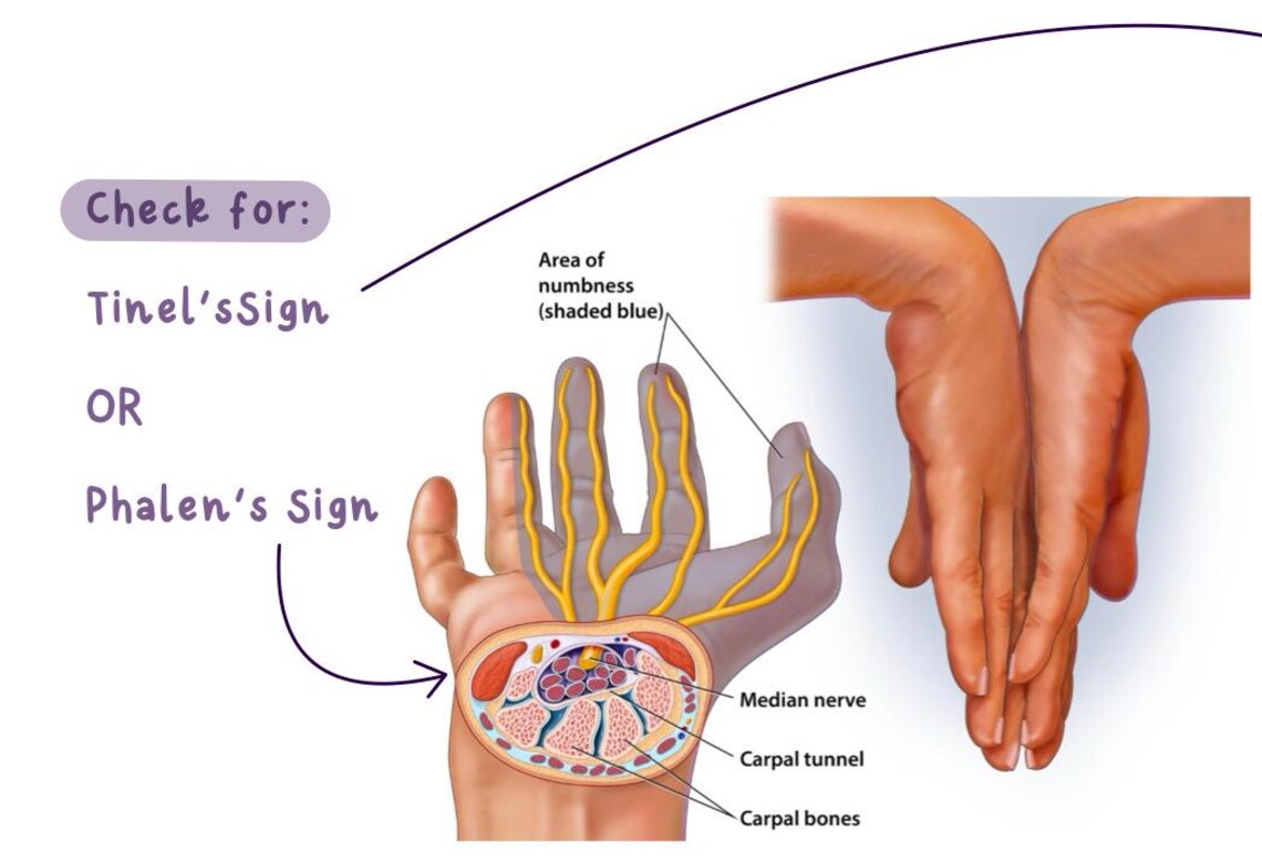 Msk-neurological Demonstration - Etsy