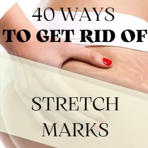 Stretch Marks: 40 Proven Prevention & Treatment Methods (EBOOK PDF)