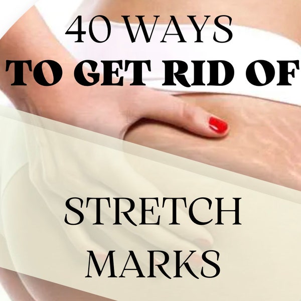 Stretch Marks Be Gone: 40 Proven Ways to Prevent and Treat Stretch Marks - 17pg - EBOOK - PDF - AUDIO - Instant Download