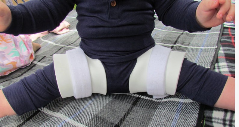 May include: A white and beige hip abduction brace with adjustable Velcro straps is worn by a child. The brace is designed to keep the legs in a specific position. The child is wearing a navy blue long-sleeved shirt and pants.
