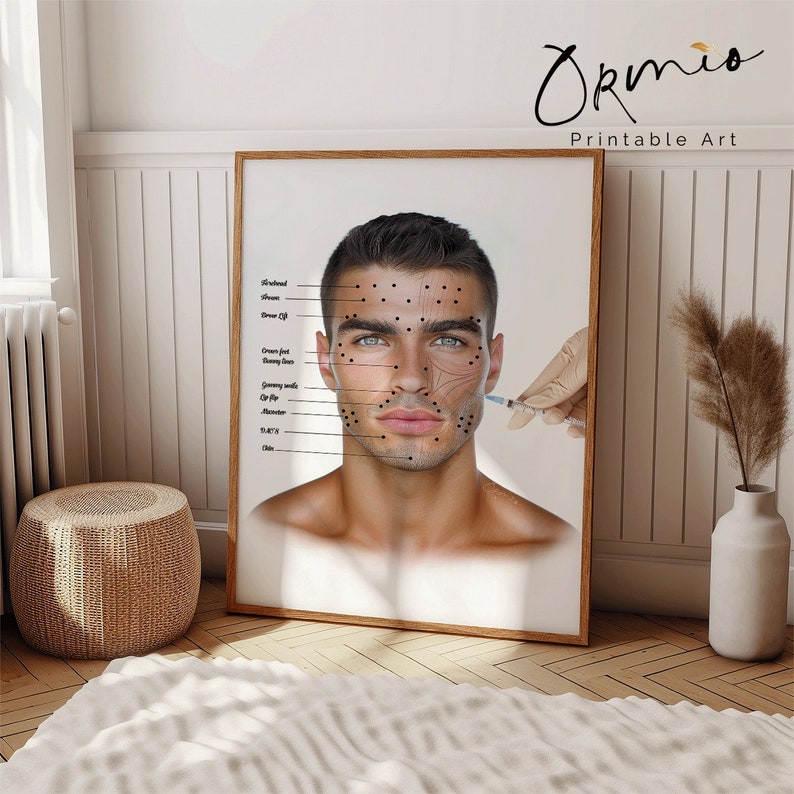 Botox Injection Points Poster: Medical Esthetician Art (digital ...
