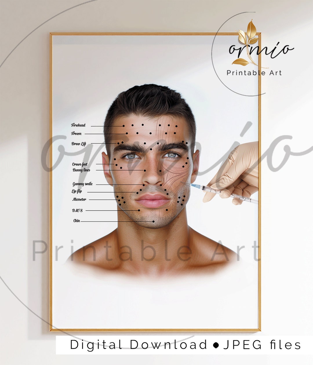 Botox Injection Points Poster, Cosmetic Injector Print, Esthetician Art ...