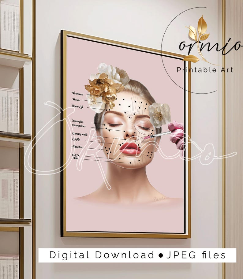 Botox Injection Points Guide | Medical Spa Decor (digital Download) - Etsy