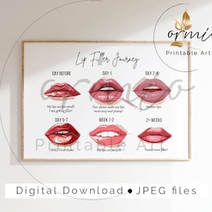 Lip Filler Journey Poster: Aesthetics Clinic Decor (Printable Art)