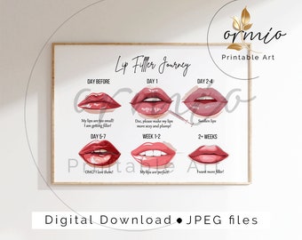 Lip Filler Journey Poster: Aesthetics Clinic Decor (Printable Art)