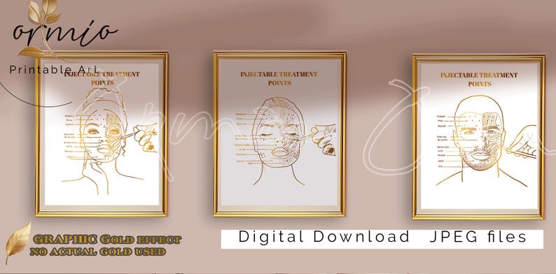 Set of three printable posters in gold linear design showing Botox injection points on a man, a woman, and a woman of color. Labeled areas include forehead, crow's feet, lip flip, bunny lines, masseter, and chin. Ideal for aesthetic professionals.