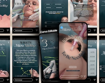 Microneedling Instagram Story Templates: Esthetician Marketing (Canva Editable)