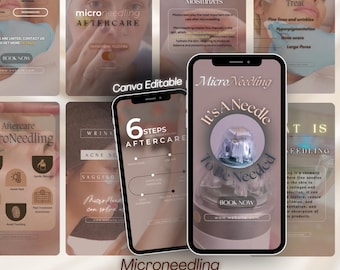 Microneedling Instagram Reels: Esthetician Social Media Templates (Canva Editable, 4K UHD)