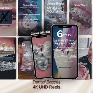 Plantillas de reels de aparatos dentales: Ortodoncista en Instagram (Canva editable)