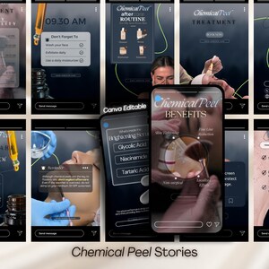 Chemical Peel Instagram Templates: Skincare Social Media (Canva Editable)