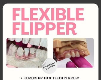 Missing Tooth Solution. Custom Flexible Flipper with Home Impression Kit. Covers Up to Three Missing Teeth in a Row.