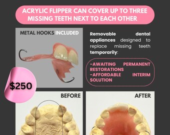 Create Your Ideal Fit: Dental Impression Kit for Partial Dentures, Snap-On Veneers, Flippers, Retainers and Beyond