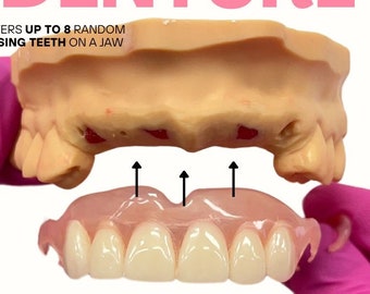 Custom Flexible Partial Dentures. Affordable Solution for Missing Teeth. Free Shipping. Free Impression Kit Included.