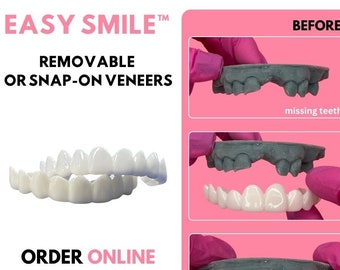 Easy Smile Removable Snap On Veneers. Affordable Cosmetic Dental Solution.