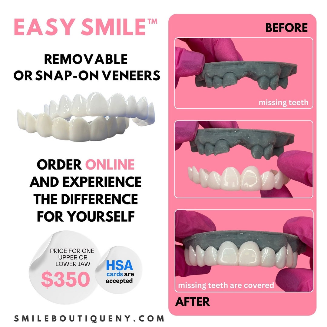 Innovative Smile Solutions Dental Impression Kit for Dentures, Pop on