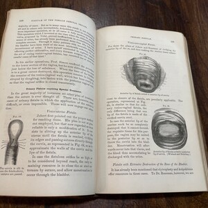1872 Practical Treatise of the Diseases on Women by T Gaillard Thomas ...