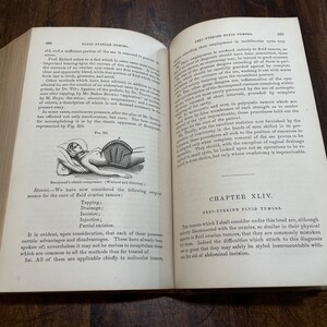 1872 Practical Treatise of the Diseases on Women by T Gaillard Thomas ...