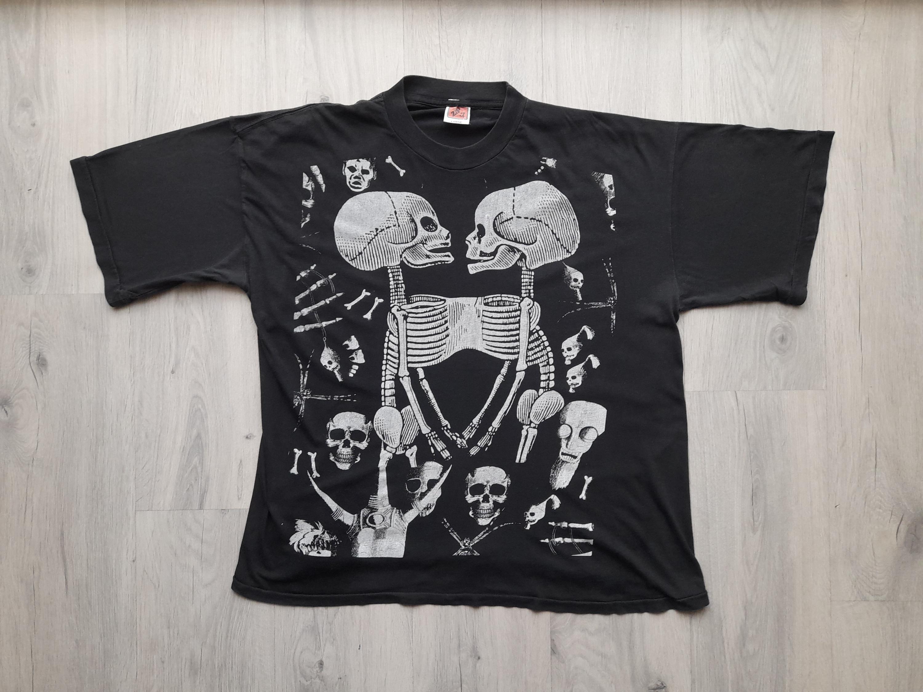 ★SURGERY★ siamese twin type-2 T-shirts Siamese Twins T-Shirts for Sale by Science Source Prints