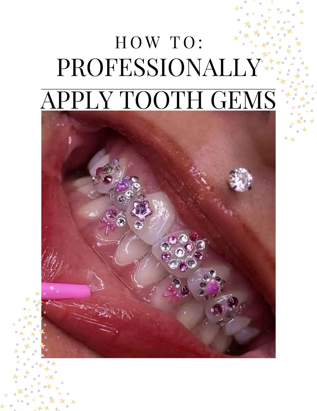 Tooth Gem Application Mastery: A Professional Guide to Adorning Smiles ...
