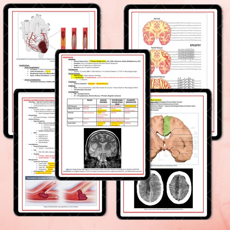 K&ouml;nnte beinhalten: Mehrere Tablets mit digitalen medizinischen Lernmaterialien. Die Guides zeigen detaillierte anatomische Illustrationen von Herz, Gehirn und Gef&auml;&szlig;systemen sowie medizinische Fachbegriffe und Diagramme zu neurologischen Erkrankungen.