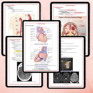 K&ouml;nnte beinhalten: Mehrere Tablets mit digitalen medizinischen Lernmaterialien. Die Themen umfassen die Koronarzirkulation und Arten von Hirnblutungen. Die Tablets haben schwarze R&auml;nder und wei&szlig;e Hintergr&uuml;nde. Diagramme und Text sind enthalten.