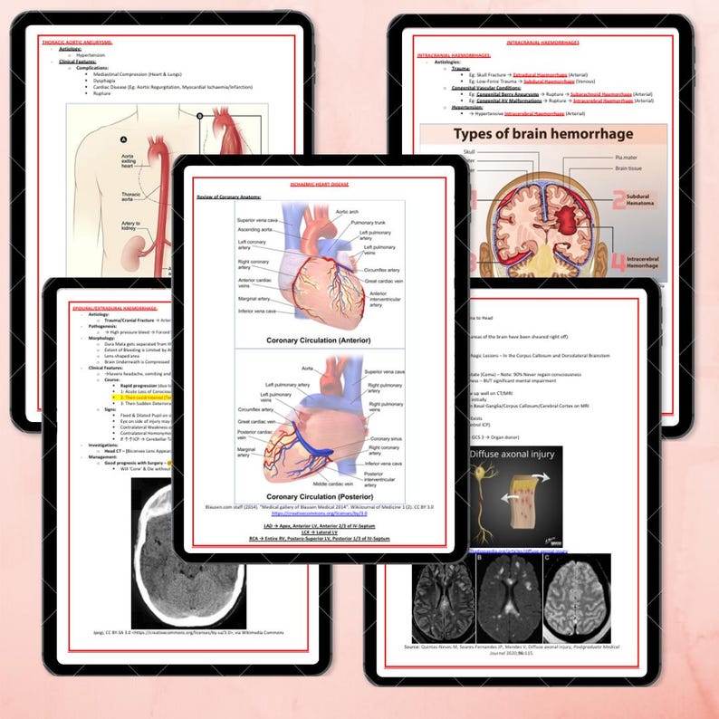 K&ouml;nnte beinhalten: Mehrere Tablets mit digitalen medizinischen Lernmaterialien. Die Themen umfassen die Koronarzirkulation und Arten von Hirnblutungen. Die Tablets haben schwarze R&auml;nder und wei&szlig;e Hintergr&uuml;nde. Diagramme und Text sind enthalten.