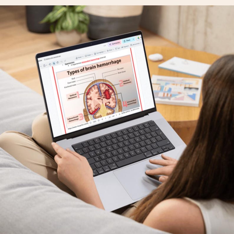 K&ouml;nnte beinhalten: Ein silberner Laptop zeigt ein medizinisches Diagramm mit dem Titel "Arten von Hirnblutungen". Das Diagramm zeigt einen Querschnitt des Gehirns mit beschrifteten Bereichen. Der Laptop ist auf dem Scho&szlig; einer Person ge&ouml;ffnet, die H&auml;nde auf der Tastatur.