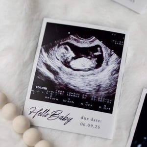 Benutzerdefinierte Ultraschall personalisierte digitale Probe, ideal für Andenken, besondere Ankündigungen, Babyparty, Schwangerschaft, Fälligkeitsankündigung