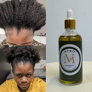 atro hair growth oil