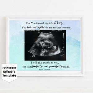 May include: A printable, editable template for a baby announcement. The template features a watercolour background in shades of blue and a black and white ultrasound image. The text reads: "For You formed my inmost being. You knit me together in my mother's womb. 21-02-15-193354 CLINIC TIS 0,2 19:37:46 I will give thanks to you, for I am fearfully and wonderfully made. Psalm 130:13-14a"