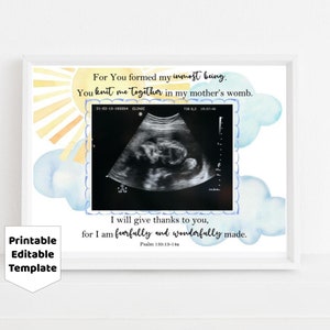 Editable Sonogram or Baby photo mat frame, Psalm 139 Fearfully Wonderfully Made