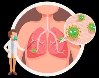 Può includere: Illustrazione dei polmoni di una persona con virus verdi al loro interno. Un medico con una maschera facciale indica i virus con un bastone. Un primo piano dei virus è mostrato in una bolla di dialogo.