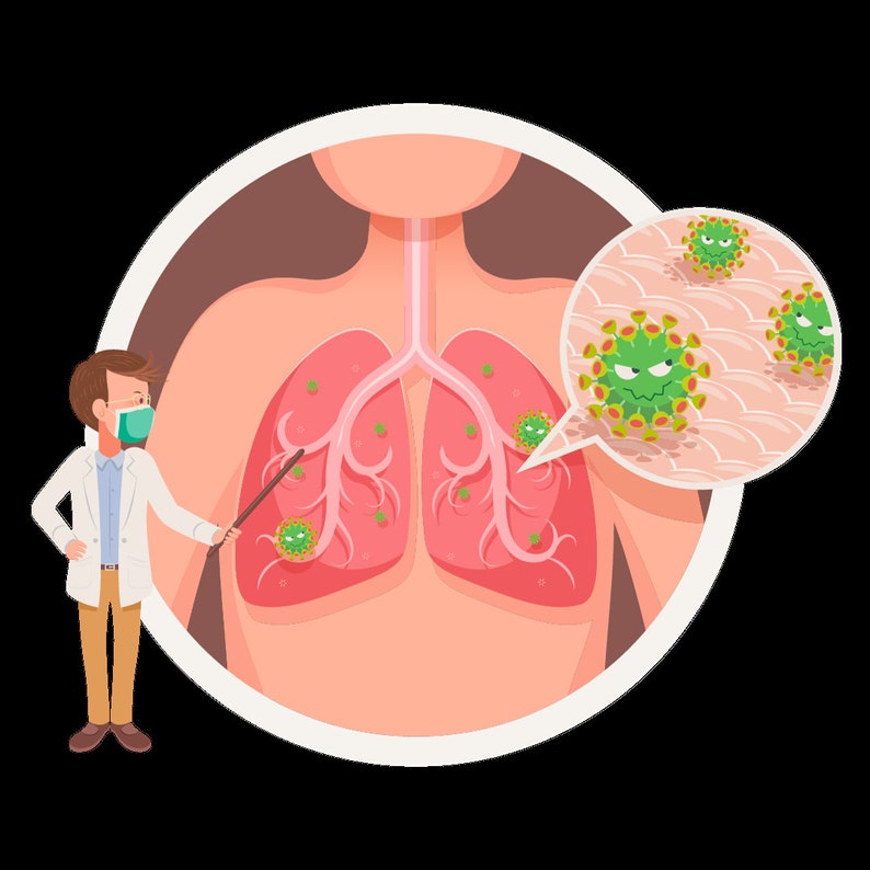 May include: Illustration of a person's lungs with green viruses inside. A doctor wearing a face mask points to the viruses with a stick. A close-up of the viruses is shown in a speech bubble.