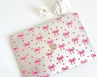Pink Bow MacBook Case, Cute Laptop Cover
