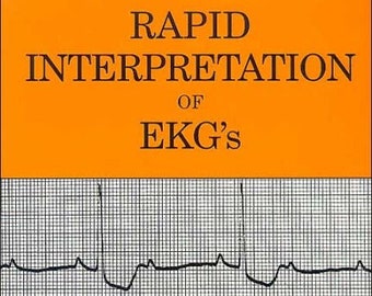Rapid Interpretation of EKG&#39;s, Sixth Edition by Dale Dubin