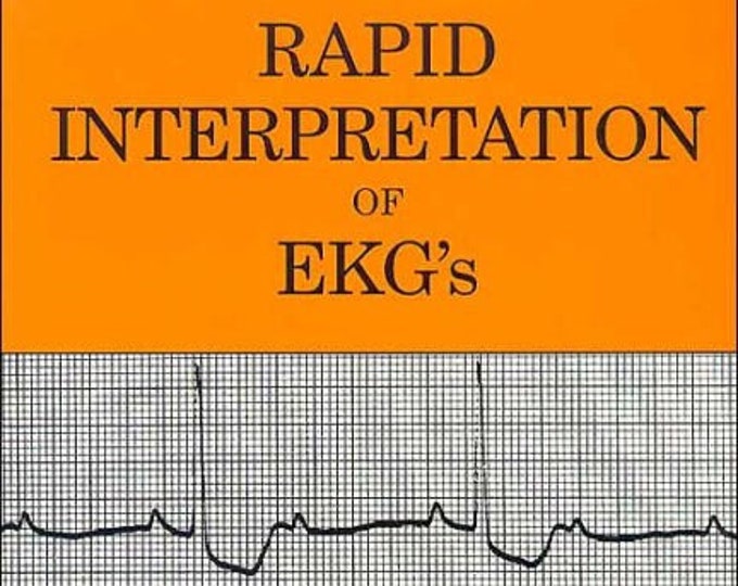 Rapid interpretation of ekg s sixth edition by dale dubin etsy