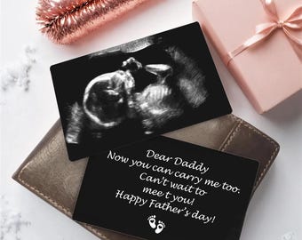 Benutzerdefinierte Ultraschall Foto Brieftasche Karte, neue Baby Sonogramm Geschenk, Brieftasche Einsatz, Schwangerschaft Geschenk, erste Mal Vater, Geschenke für ihn, Baby-Dusche-Geschenk