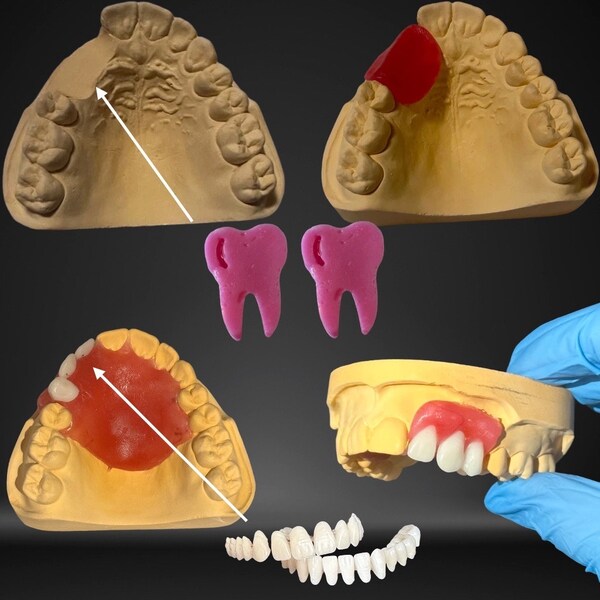 Diy Denture Kit - Etsy
