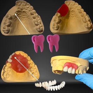 Zahnprothese,DIY Kit, Gebiss,Denture Bild 6