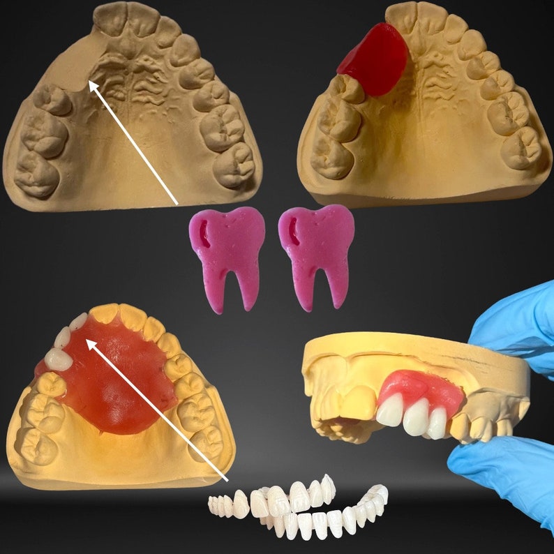 Zahnprothese,DIY Kit, Gebiss,Denture Bild 6