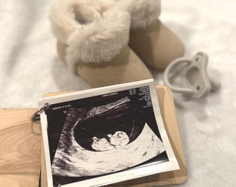 Ultraschallbuch Personalisierte Schwangerschaft Andenken Album Erwartet Mutter Geschenk Ultraschall Fotos Erinnerungen Baby Shower Geschenk Neue Mutter Mutterschaft