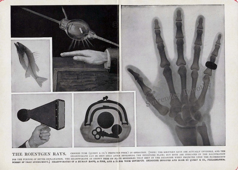 Xray Invention Roentgen Ray Machine 1911 Science
