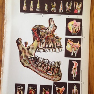 Human Anatomy Tooth Disease Creepy Tooth Fairy 1908 Medical Dental Illustration image 2