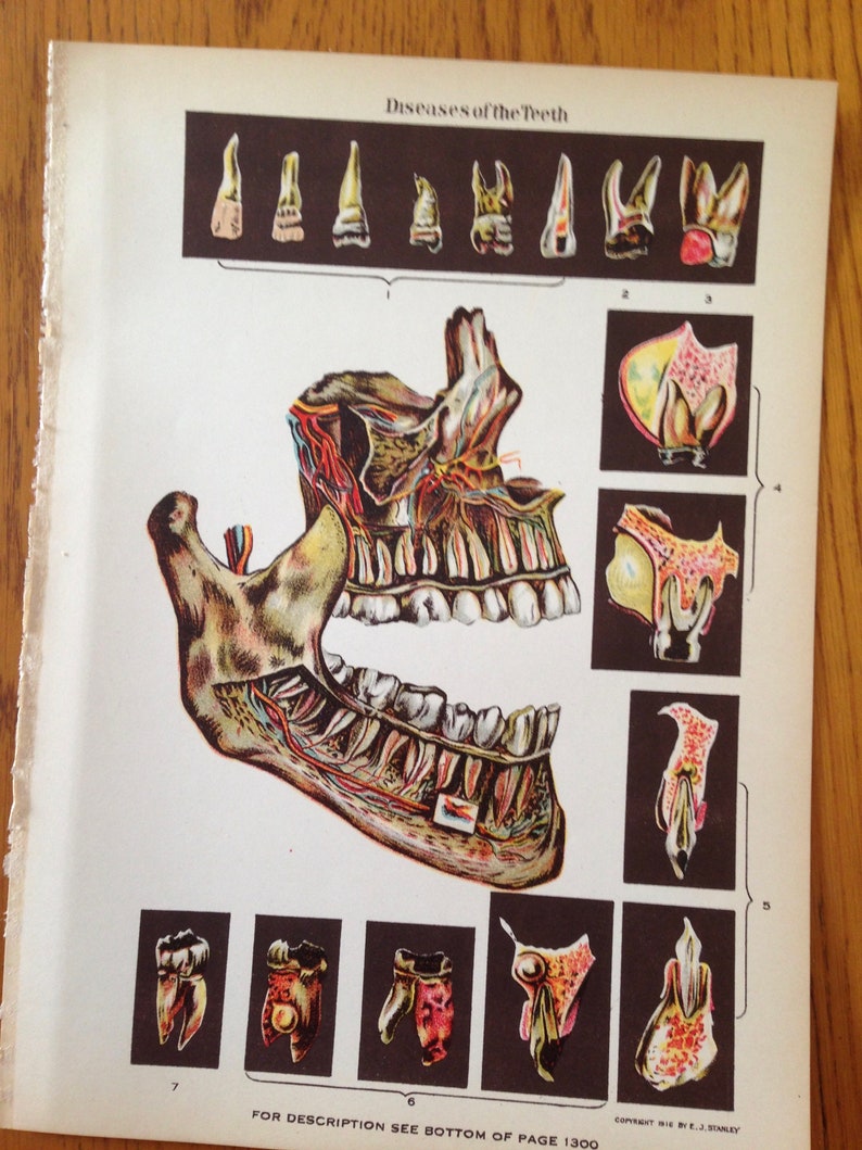 Human Anatomy Tooth Disease Creepy Tooth Fairy 1908 Medical Dental Illustration image 2