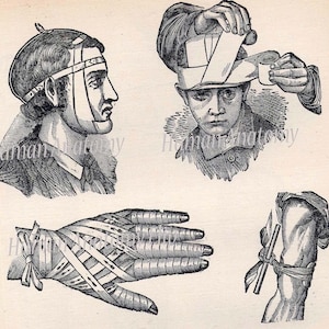 May include: A vintage illustration showing different methods of bandaging injuries. The image shows a person with a head injury, a person with a bandaged hand, and a person with a bandaged arm.