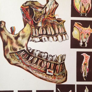 Human Anatomy Tooth Disease Creepy Tooth Fairy 1908 Medical Dental Illustration image 1