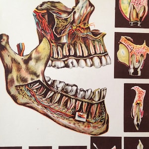 Anatomía humana Enfermedad dental Hada de los dientes espeluznante Ilustración médica dental de 1908